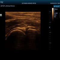 ECOGRAFO-DP-50-PT.1 - Fisio-shop