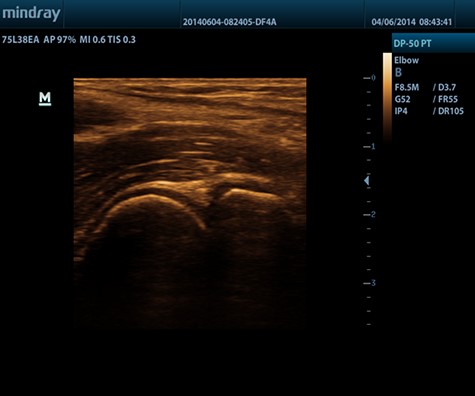 ECOGRAFO-DP-50-PT.1 - Fisio-shop