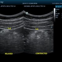 ECOGRAFO-DP-50-PT.2 - Fisio-shop
