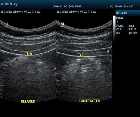 ECOGRAFO-DP-50-PT.2 - Fisio-shop