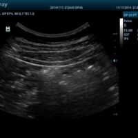 ECOGRAFO-DP-50-PT.3 - Fisio-shop