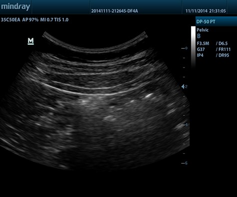 ECOGRAFO-DP-50-PT.3 - Fisio-shop