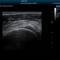 ECOGRAFO-DP-50-PT.4 - Fisio-shop