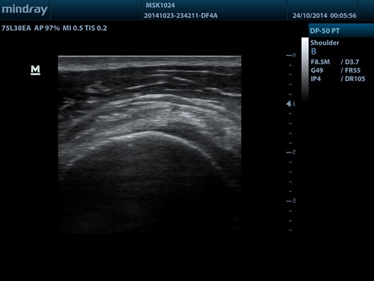 ECOGRAFO-DP-50-PT.4 - Fisio-shop