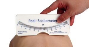 PEDI-ESCOLIÓMETRO